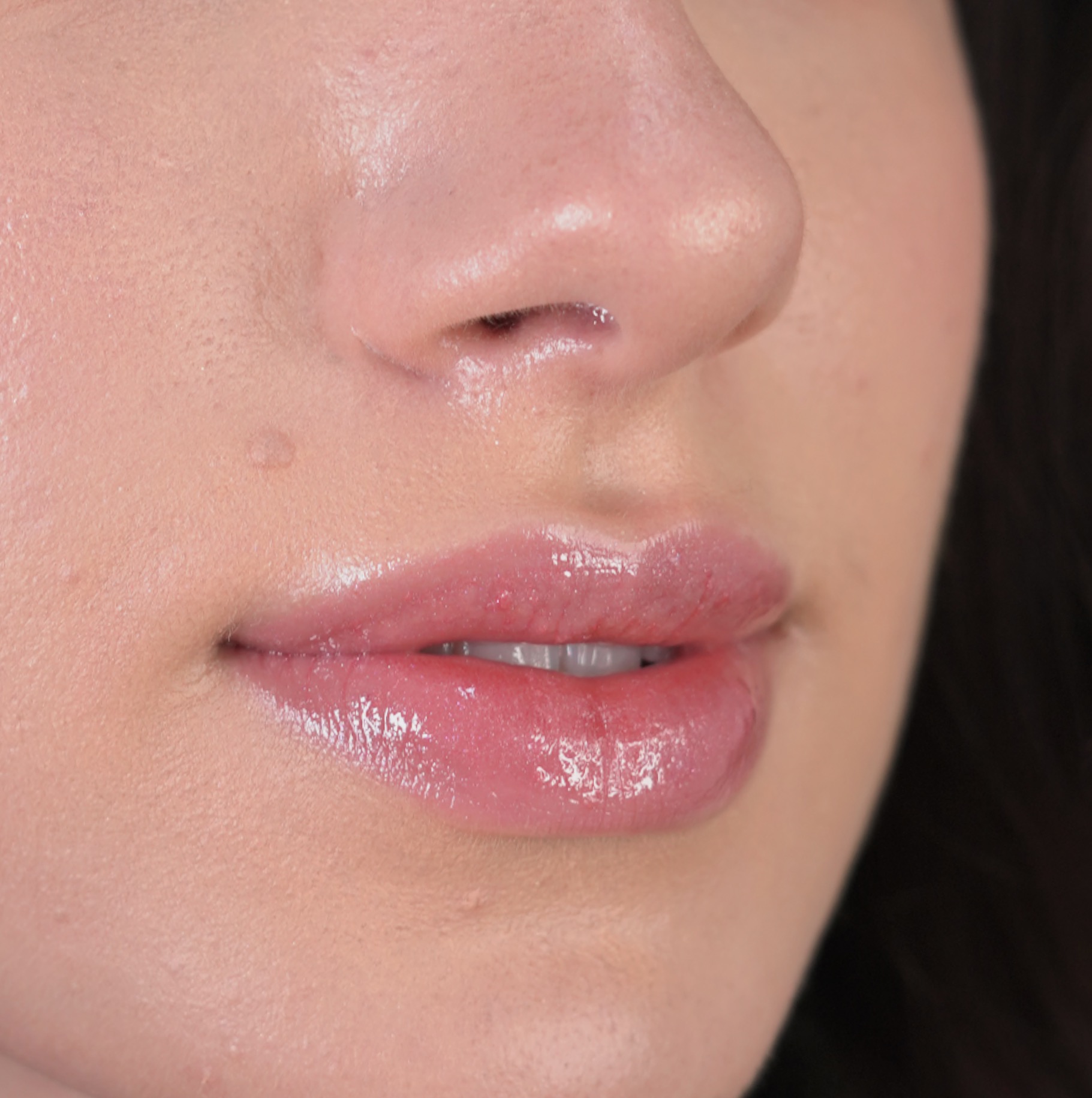 Hidratação Labial com Microagulhamento